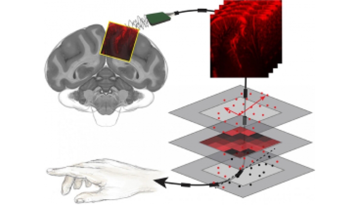 Декодирование мозговой активности с помощью ультразвуковой технологии для использования в нейрокомпьютерных интерфейсах
